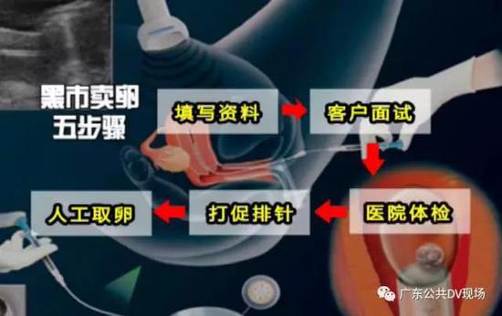 賣卵五步驟