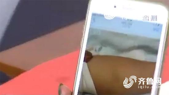 孩子被打傷口